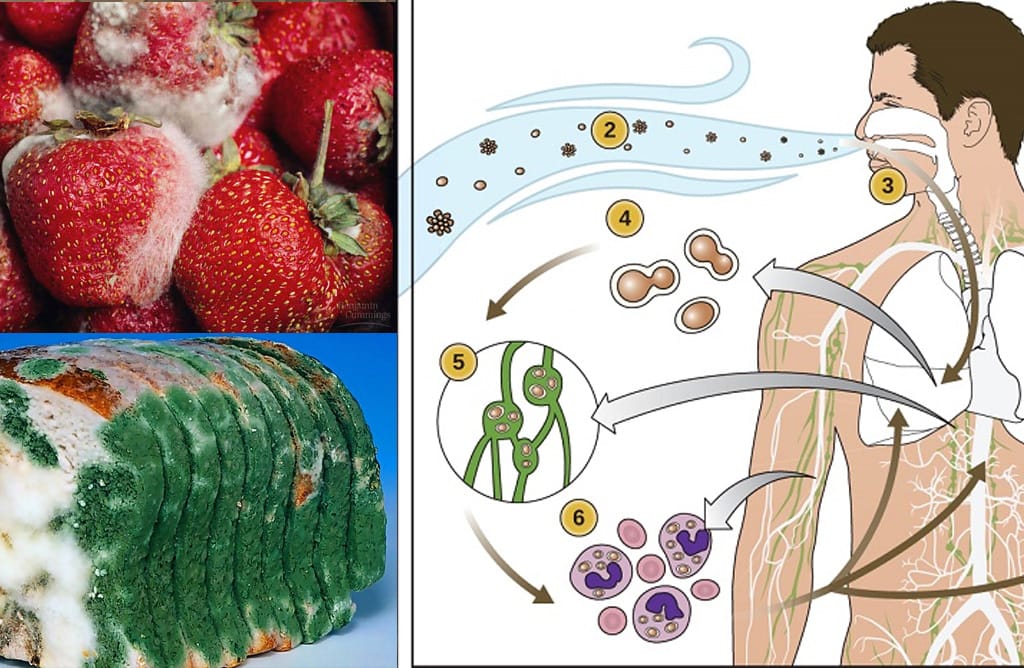 Môi trường trong nhà dễ bị nấm mốc ảnh hưởng sức khỏe